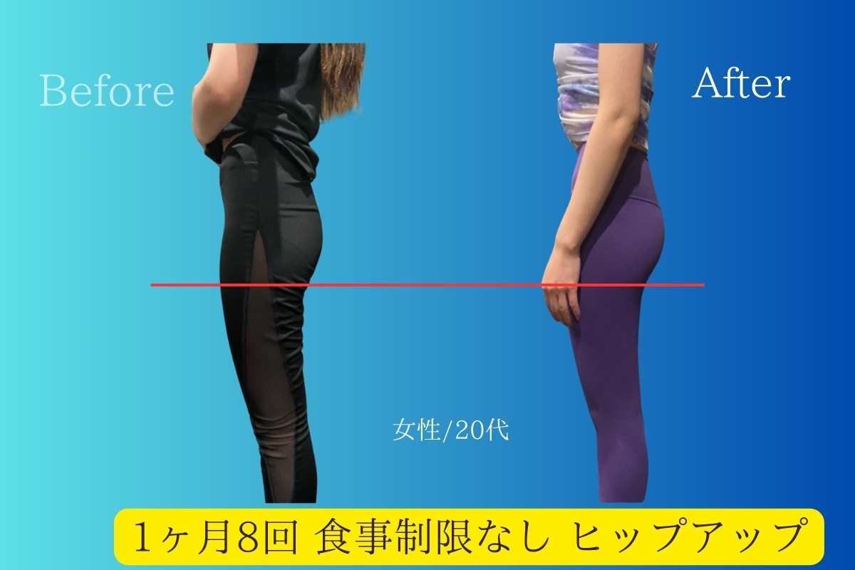 ヒップアップビフォーアフター